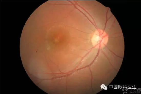 ��ͬ�۲��ĸ����۵�Ƭ