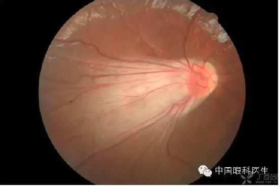 ��ͬ�۲��ĸ����۵�Ƭ