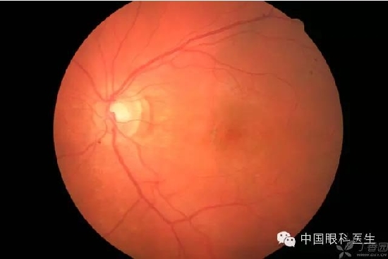 ��ͬ�۲��ĸ����۵�Ƭ