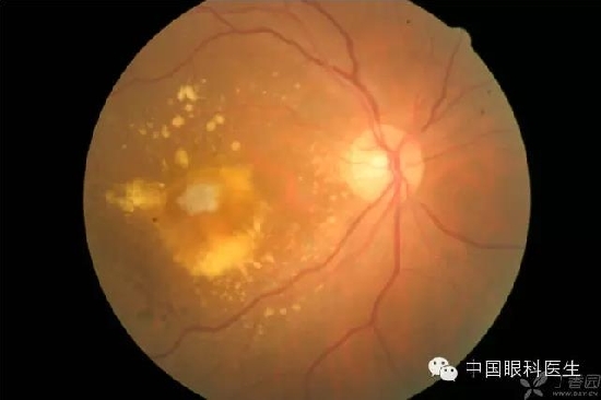 ��ͬ�۲��ĸ����۵�Ƭ