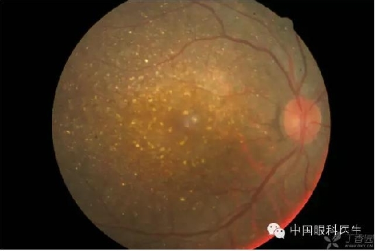 ��ͬ�۲��ĸ����۵�Ƭ