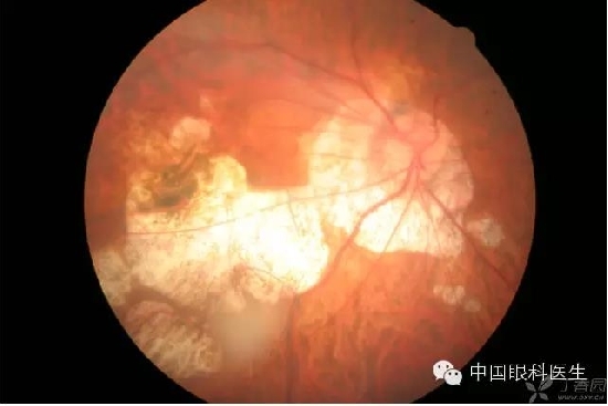 ��ͬ�۲��ĸ����۵�Ƭ