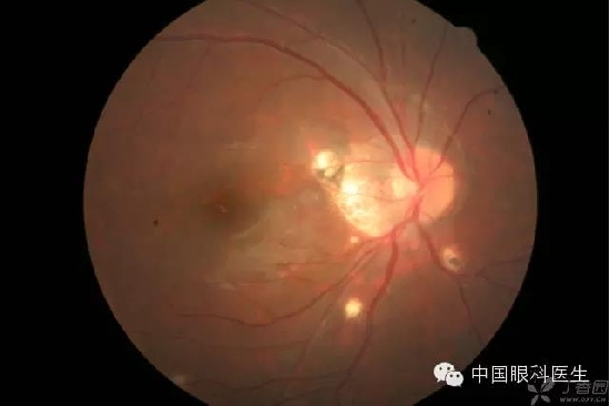 ��ͬ�۲��ĸ����۵�Ƭ