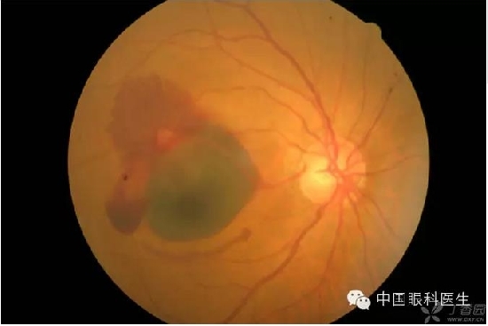 ��ͬ�۲��ĸ����۵�Ƭ