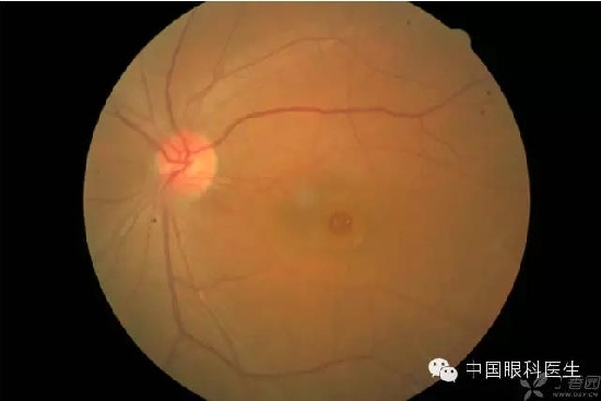 ��ͬ�۲��ĸ����۵�Ƭ