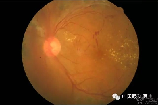 ��ͬ�۲��ĸ����۵�Ƭ