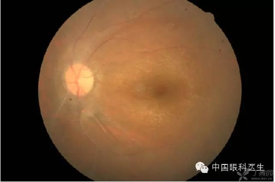 ��ͬ�۲��ĸ����۵�Ƭ