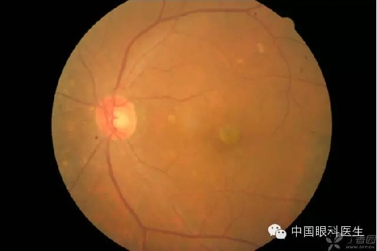 ��ͬ�۲��ĸ����۵�Ƭ