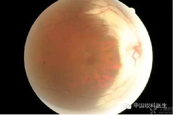 ��ͬ�۲��ĸ����۵�Ƭ