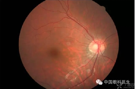 ��ͬ�۲��ĸ����۵�Ƭ