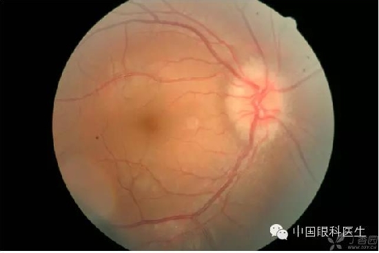 ��ͬ�۲��ĸ����۵�Ƭ