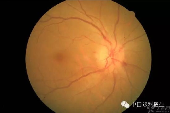 ��ͬ�۲��ĸ����۵�Ƭ