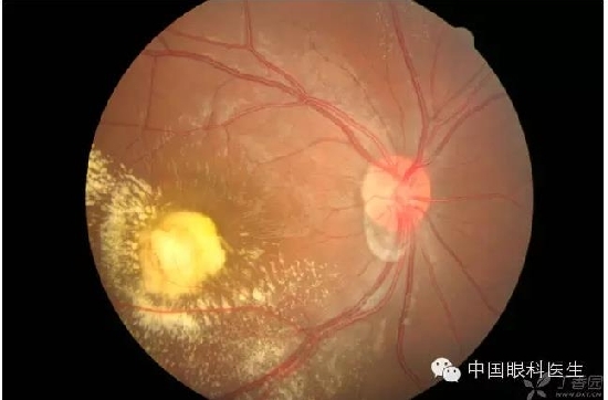 ��ͬ�۲��ĸ����۵�Ƭ