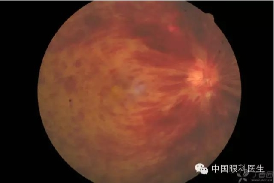 ��ͬ�۲��ĸ����۵�Ƭ