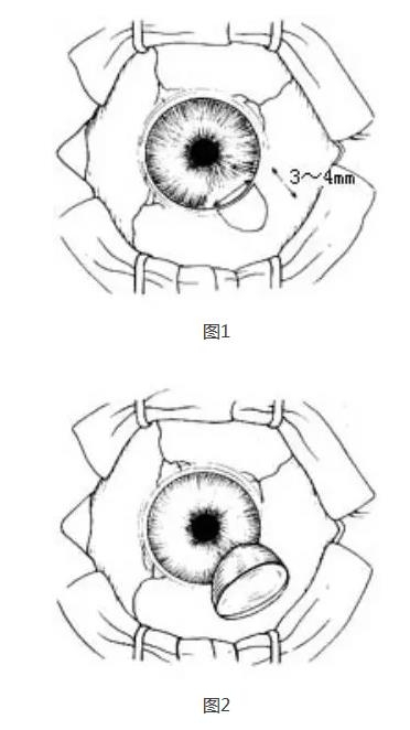 �ܱߺ�Ĥ�г���