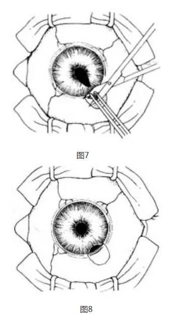 �ܱߺ�Ĥ�г���