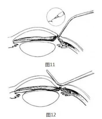 �ܱߺ�Ĥ�г���