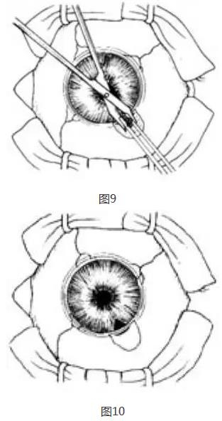 �ܱߺ�Ĥ�г���