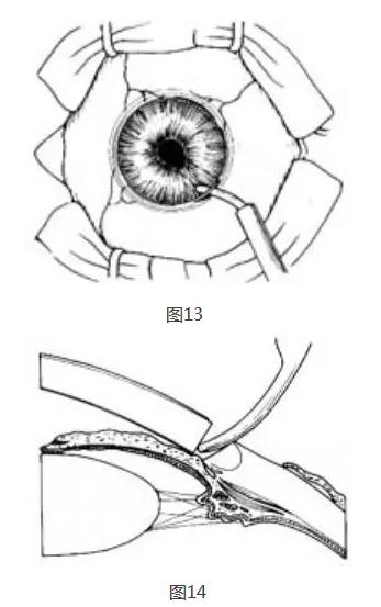 �ܱߺ�Ĥ�г���