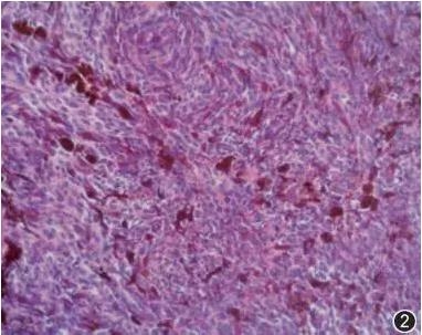 ����������״������Ĥ��ɫ����