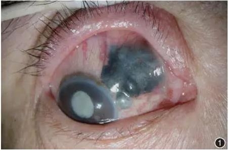 ����������״������Ĥ��ɫ����