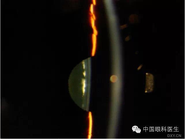 ��ͬ�ۿƼ�������ǰ����Ƭ