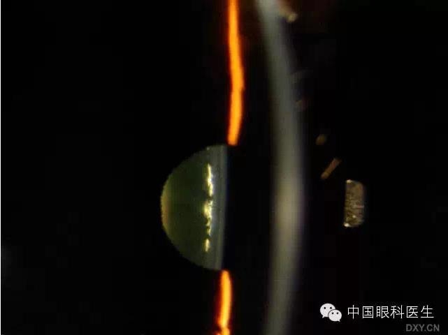 ��ͬ�ۿƼ�������ǰ����Ƭ