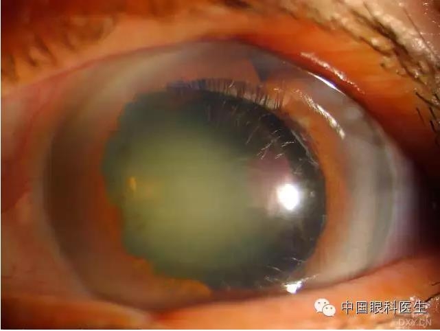 ��ͬ�ۿƼ�������ǰ����Ƭ