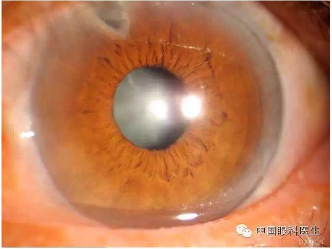 ��ͬ�ۿƼ�������ǰ����Ƭ