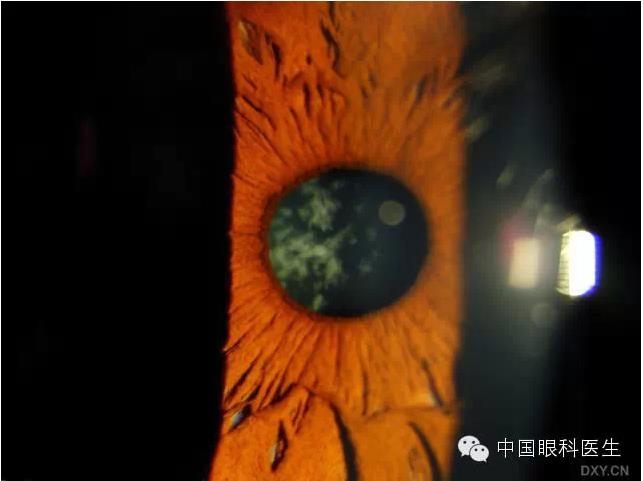 ��ͬ�ۿƼ�������ǰ����Ƭ