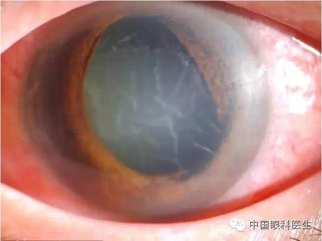 ��ͬ�ۿƼ�������ǰ����Ƭ