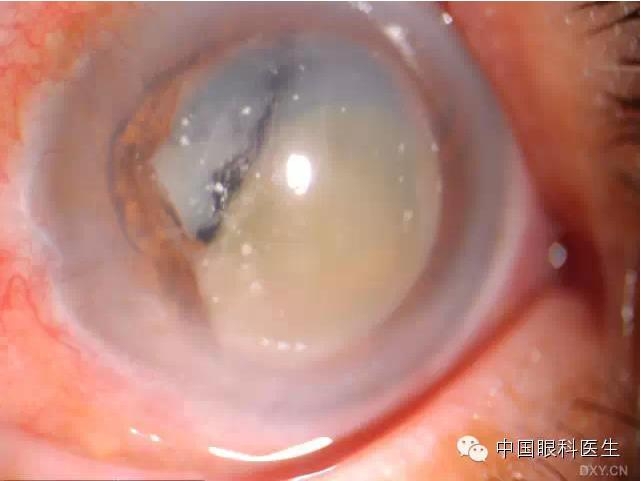 ��ͬ�ۿƼ�������ǰ����Ƭ