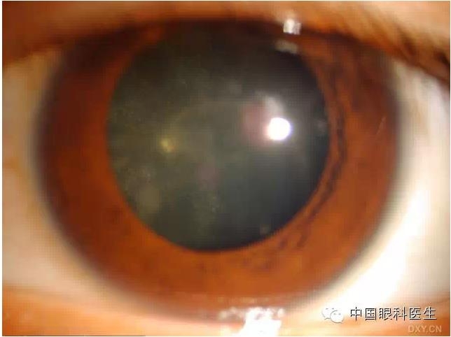 ��ͬ�ۿƼ�������ǰ����Ƭ