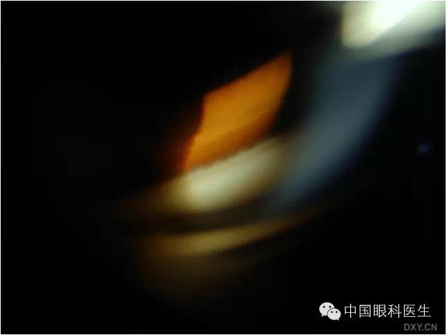 ��ͬ�ۿƼ�������ǰ����Ƭ