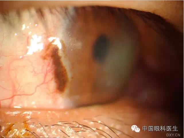 ��ͬ�ۿƼ�������ǰ����Ƭ