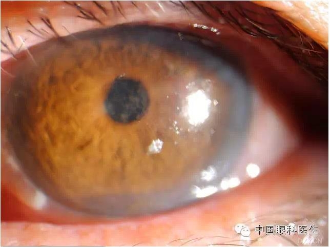 ��ͬ�ۿƼ�������ǰ����Ƭ