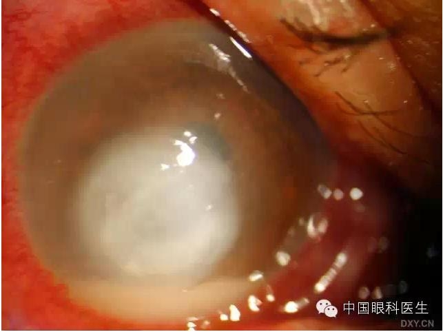 ��ͬ�ۿƼ�������ǰ����Ƭ