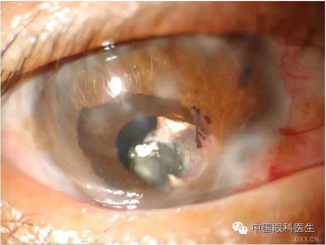 ��ͬ�ۿƼ�������ǰ����Ƭ