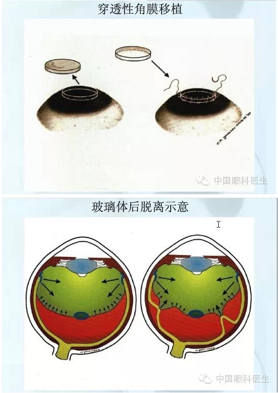 �ۿƿμ�����ͼ�ף��ղأ�ת�裬PPT��ȱͼ��