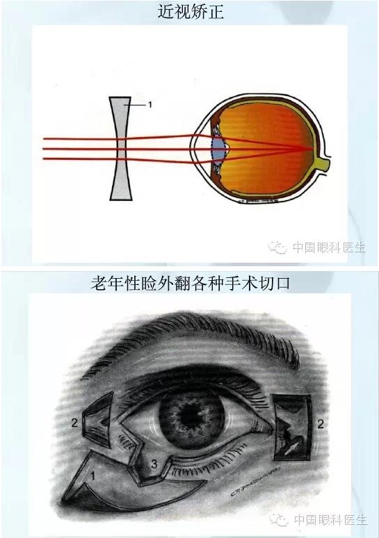 �ۿƿμ�����ͼ�ף��ղأ�ת�裬PPT��ȱͼ��