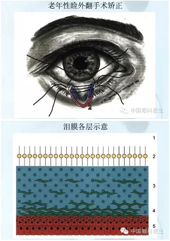 �ۿƿμ�����ͼ�ף��ղأ�ת�裬PPT��ȱͼ��