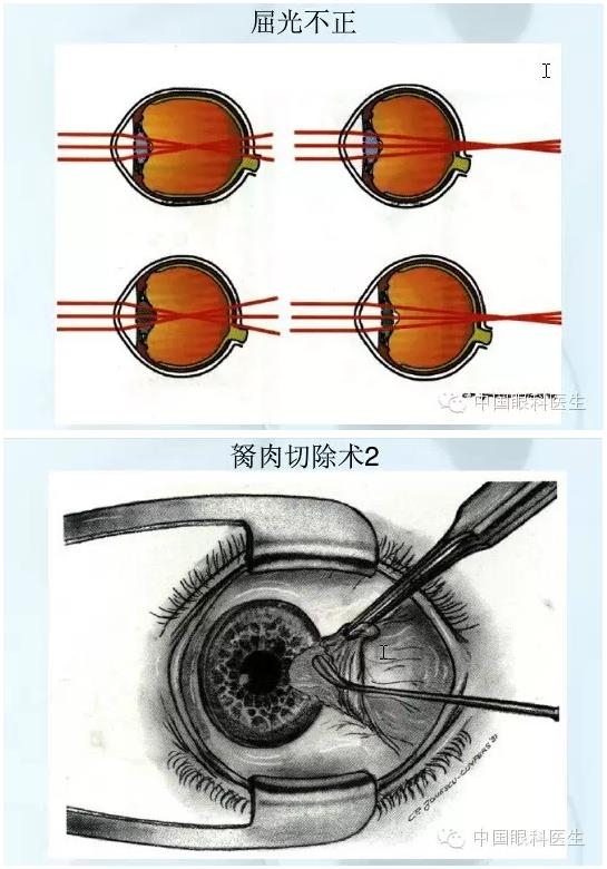 �ۿƿμ�����ͼ�ף��ղأ�ת�裬PPT��ȱͼ��