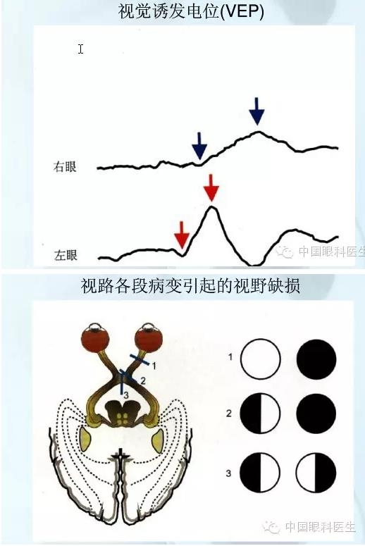 �ۿƿμ�����ͼ�ף��ղأ�ת�裬PPT��ȱͼ��