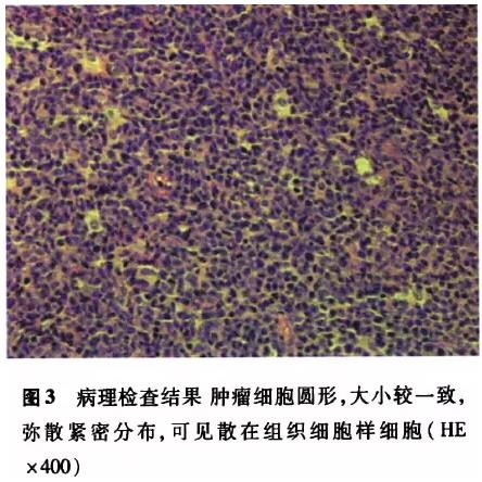 ���������ۿ�Tϸ���ܰ�ĸϸ��������Ϊ���Լ���һ��