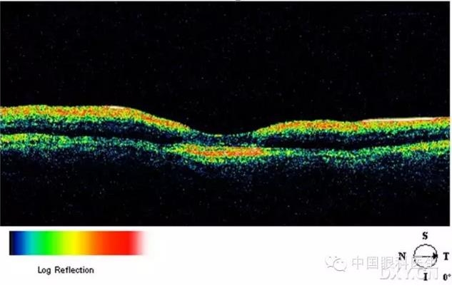 9��OCT��ͼ������ѧ��ɶϲ���������������ο���