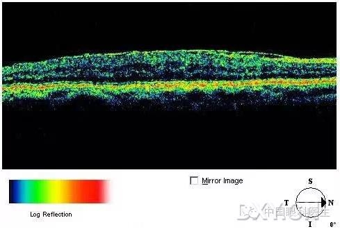 9��OCT��ͼ������ѧ��ɶϲ���������������ο���