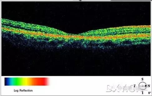 9��OCT��ͼ������ѧ��ɶϲ���������������ο���