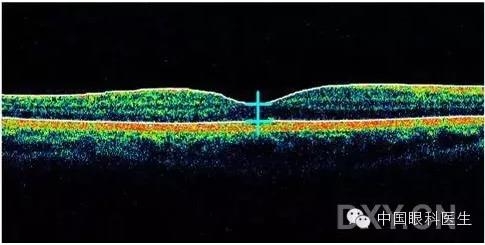 9��OCT��ͼ������ѧ��ɶϲ���������������ο���