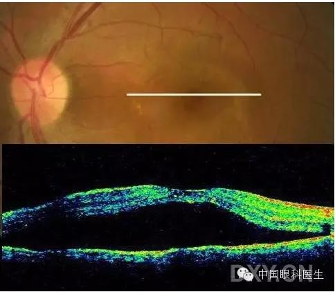 9��OCT��ͼ������ѧ��ɶϲ���������������ο���