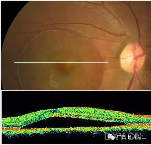 9��OCT��ͼ������ѧ��ɶϲ���������������ο���